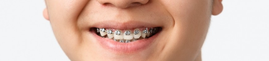 Orthodontics | Surdental Suprimentos